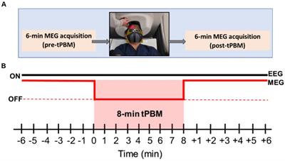 Simultaneous MEG and EEG source imaging of electrophysiological activity in response to acute transcranial photobiomodulation